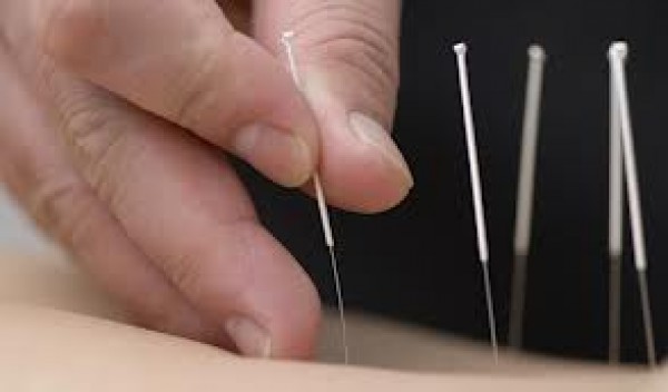accupuncture vs douleur aigue