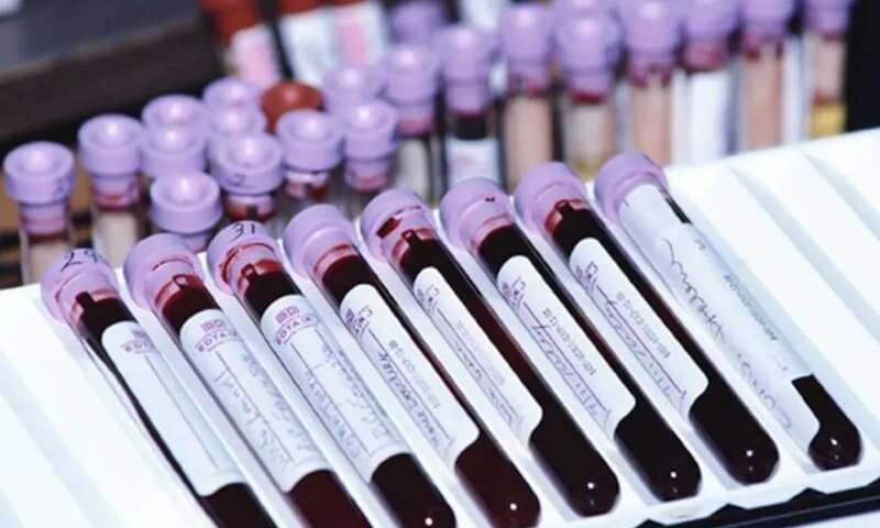 Votre groupe sanguin peut prédire votre risque de COVID-19 sévère